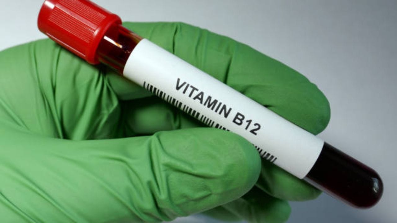 Vitamin B12 Deficiency শরীরে ভিটামিন বি১২এর ঘাটতি, বুঝবেন কোন লক্ষণে