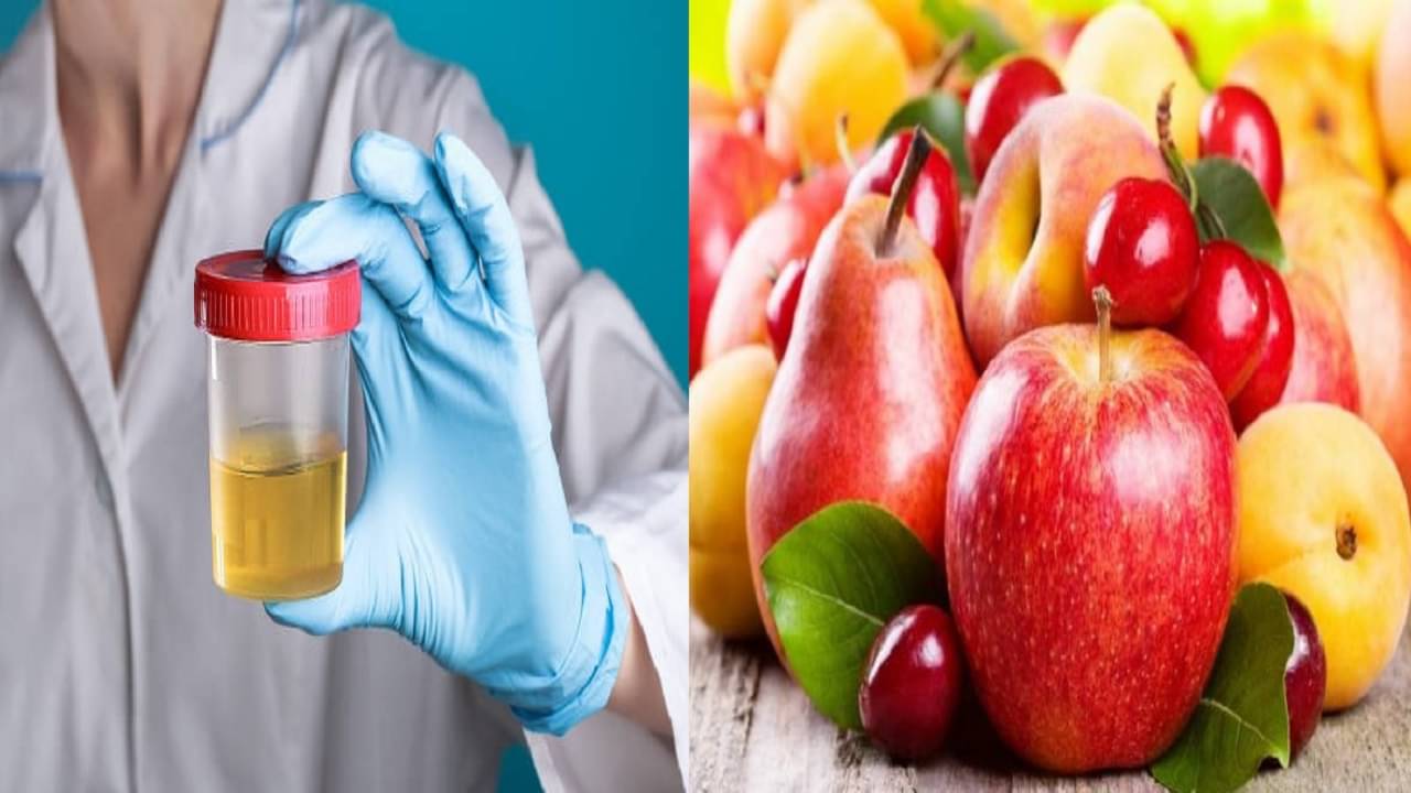 Home Remedies For Uric Acid: লাগবে না ওষুধ, সস্তার এই ৫ ফলের চোখরাঙানিতেই বিদায় নেবে ইউরিক অ্যাসিড