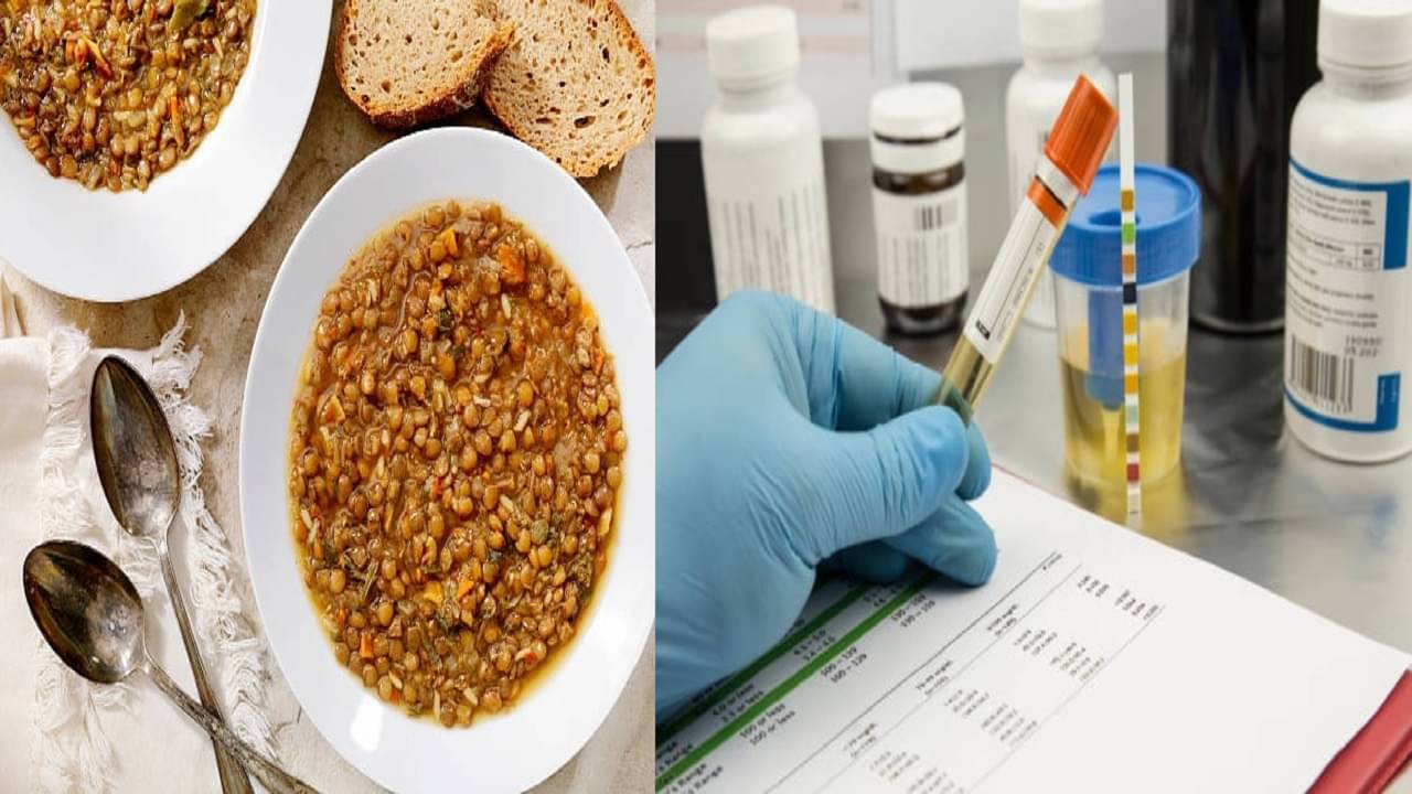 Uric Acid: কেন ইউরিক অ্যাসিডে টমেটো, মুসুর ডাল ও পাঁঠার মাংস এড়িয়ে যাওয়ার পরামর্শ দেওয়া হয়? জানুন আসল কারণ...