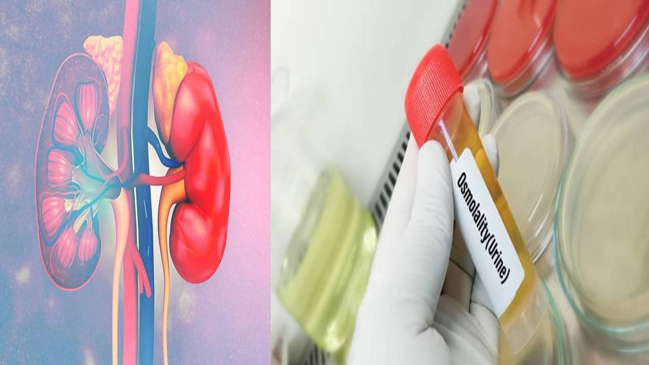 Bladder Cancer Awareness Month: বারবার বাথরুমে ছুটেও মিটছে না হচ্ছে না প্রস্রাবের সমস্যা! ব্লা়ডার ইনফেকশন নাকি অন্য সমস্যা?