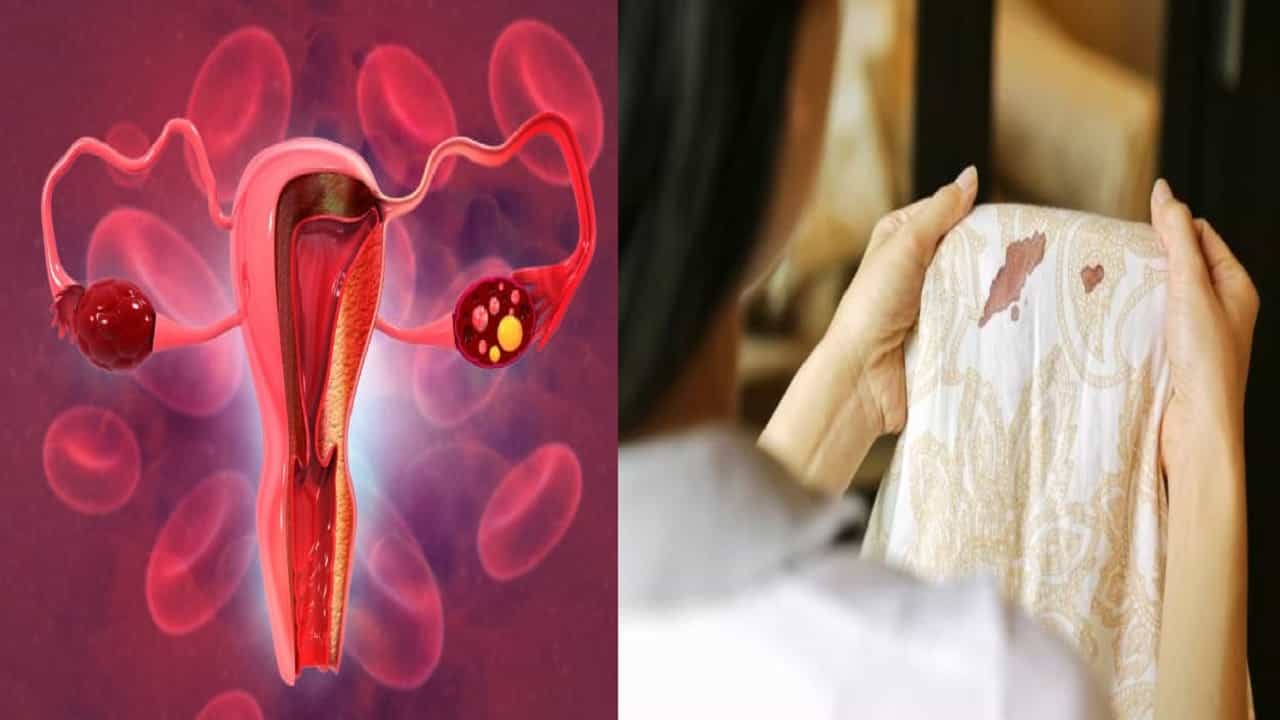 Period Blood Clots: কেন পিরিয়ডের সময় ক্লট বেশি হয়? জানুন কারণ... Period Blood Clots: কেন পিরিয়ডের সময় ক্লট বেশি হয়? জানুন কারণ...