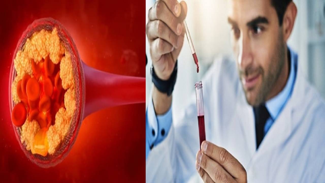 High cholesterol: রক্তে কোলেস্টেরলের মাত্রা ঠিক কতখানি থাকলে দূরে থাকবে হার্ট অ্যাটাক বা স্ট্রোকের সম্ভাবনা?