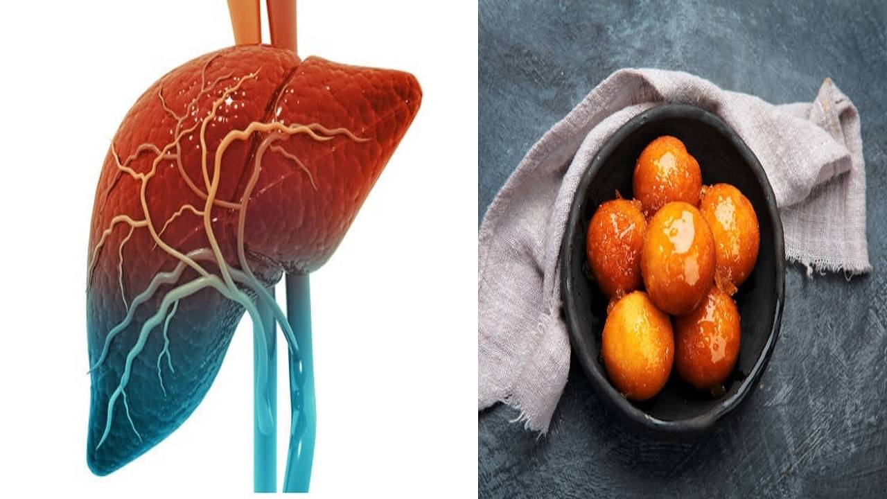 Fatty Liver: ফ্যাটি লিভারে আক্রান্ত? কোন কোন জিনিসকে ঘেঁষতেই দেবেন না ত্রিসীমানায়, জানুন...