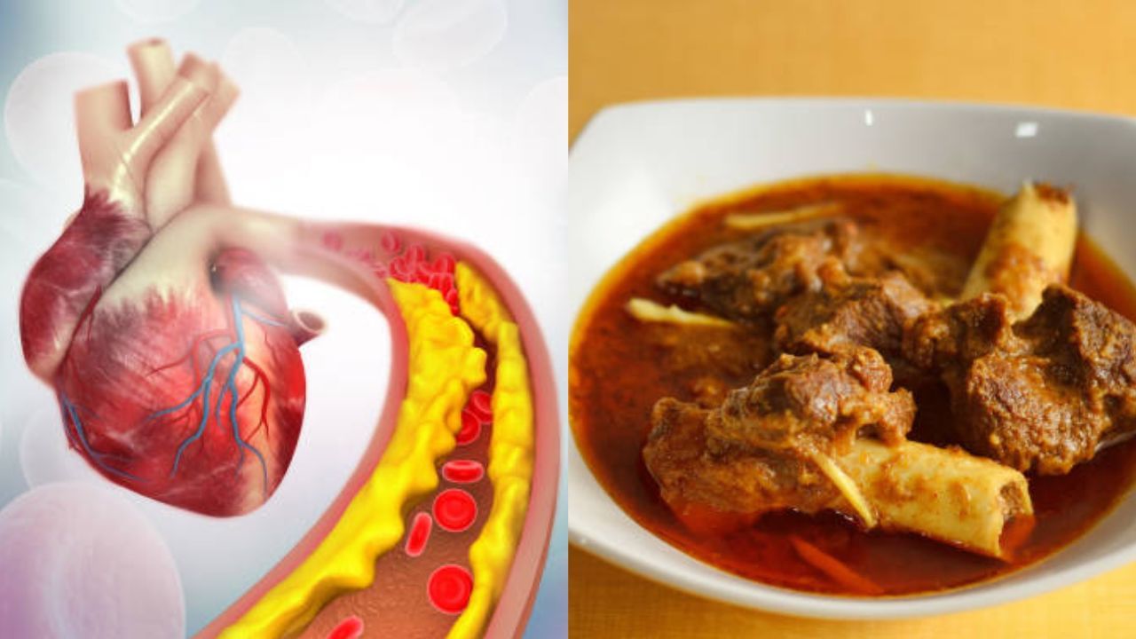 Cholesterol কোলেস্টেরল রোগী হয়েও উইকএন্ডে মাটন কষা ছাড়া চলে না? মারাত্মক ক্ষতি করছেন