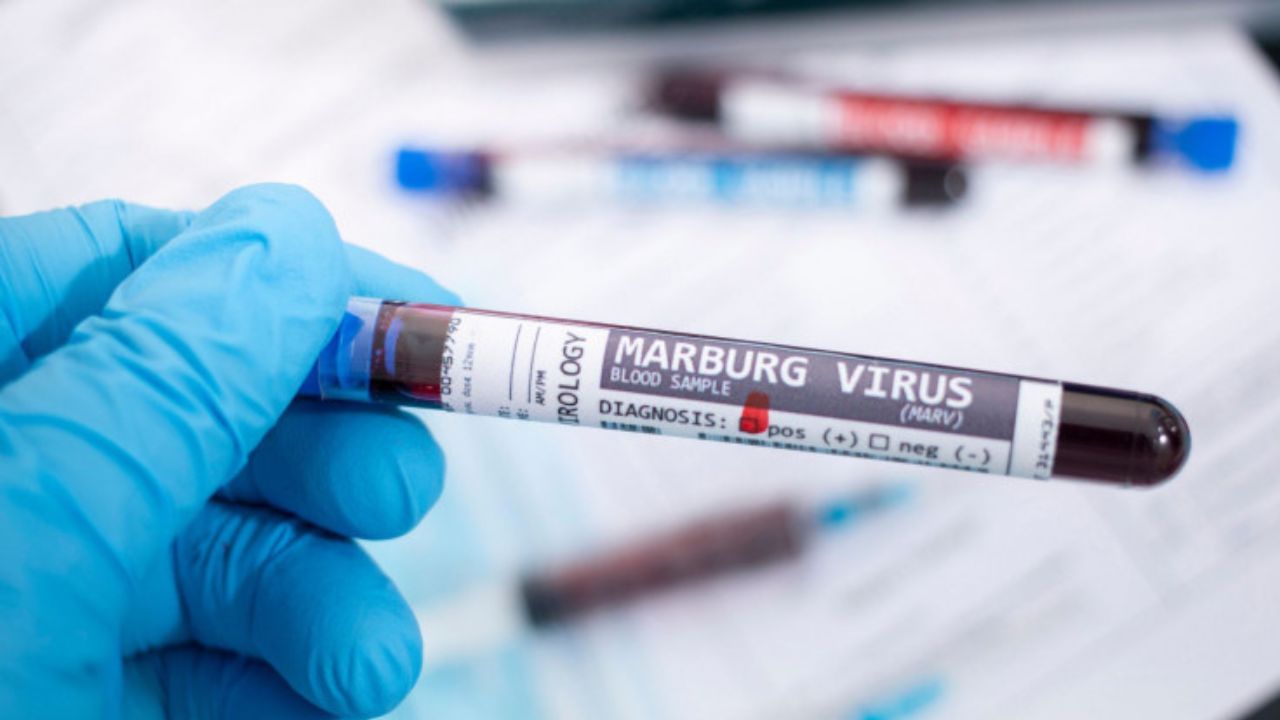 Marburg virus: করোনার থেকেও ভয়ঙ্কর ভাইরাস মারবার্গ! মৃ্ত্যুর হার দেখে আশঙ্কার বার্তা WHO-র