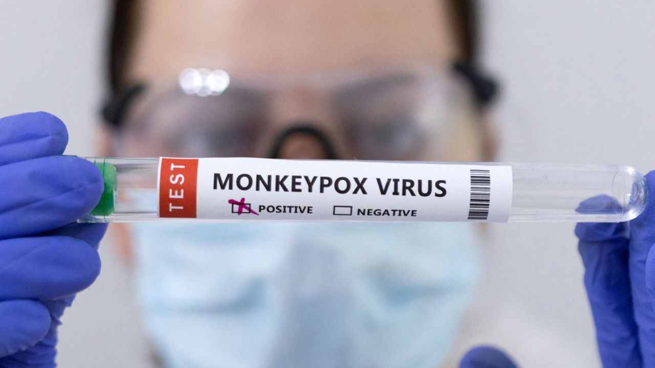 Monkeypox Virus: উদ্বেগ বাড়িয়ে মাঙ্কিপক্স কি গোষ্ঠী সংক্রমণের পথে? সমকামীদের ফের সতর্ক করে কিসের ইঙ্গিত হু-এর