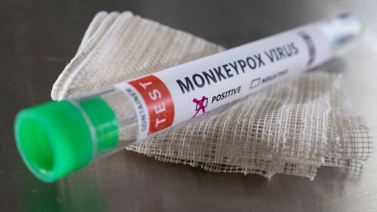 Monkeypox In India : ভারতে আরও চওড়া হচ্ছে মাঙ্কিপক্সের থাবা! খোঁজ মিলল ফের এক সংক্রমিতের