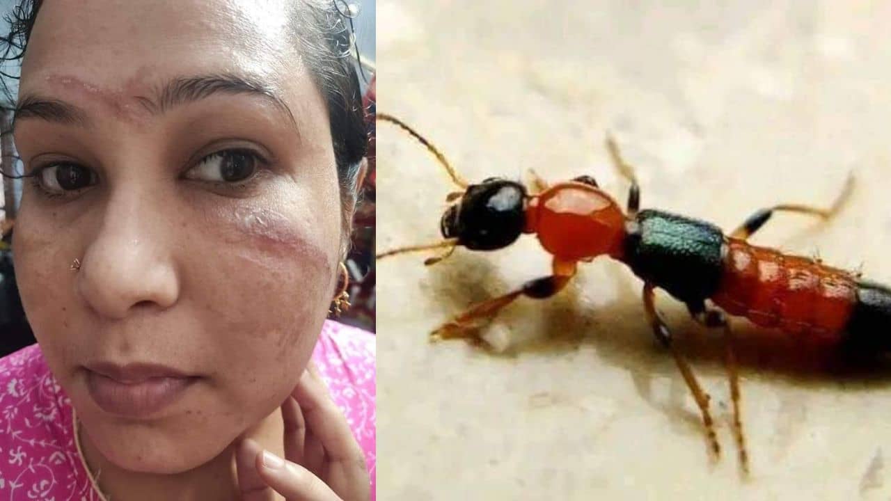 Siliguri: বাড়ছে নাইরোবি ফ্লাই-এর আতঙ্ক! এই পোকার বিষ চোখে লাগলে ঘনিয়ে আসতে পারে অন্ধত্বও