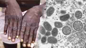 Monkeypox in India: চতুর্থ ঢেউ-এর আবহে ভারতে এবার মাঙ্কিপক্স! কেরলে খোঁজ মিলল প্রথম আক্রান্তের