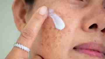 Skincare Tips: পিগমেন্টশনের জন্য ত্বক যাচ্ছে বুড়িয়ে! এই ৫ ঘরোয়া ফেসপ্যাকেই মিটবে সব সমস্যা