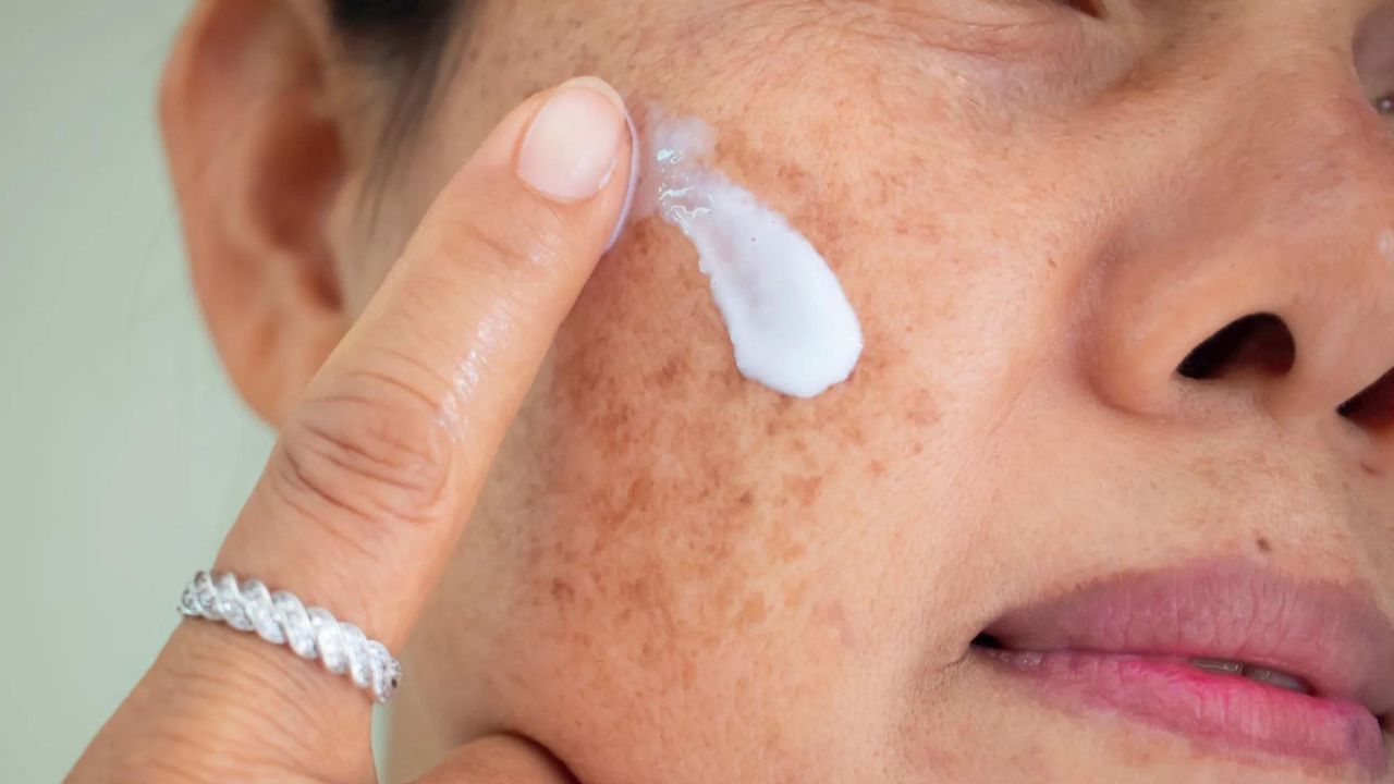 Skincare Tips: পিগমেন্টশনের জন্য ত্বক যাচ্ছে বুড়িয়ে! এই ৫ ঘরোয়া ফেসপ্যাকেই মিটবে সব সমস্যা