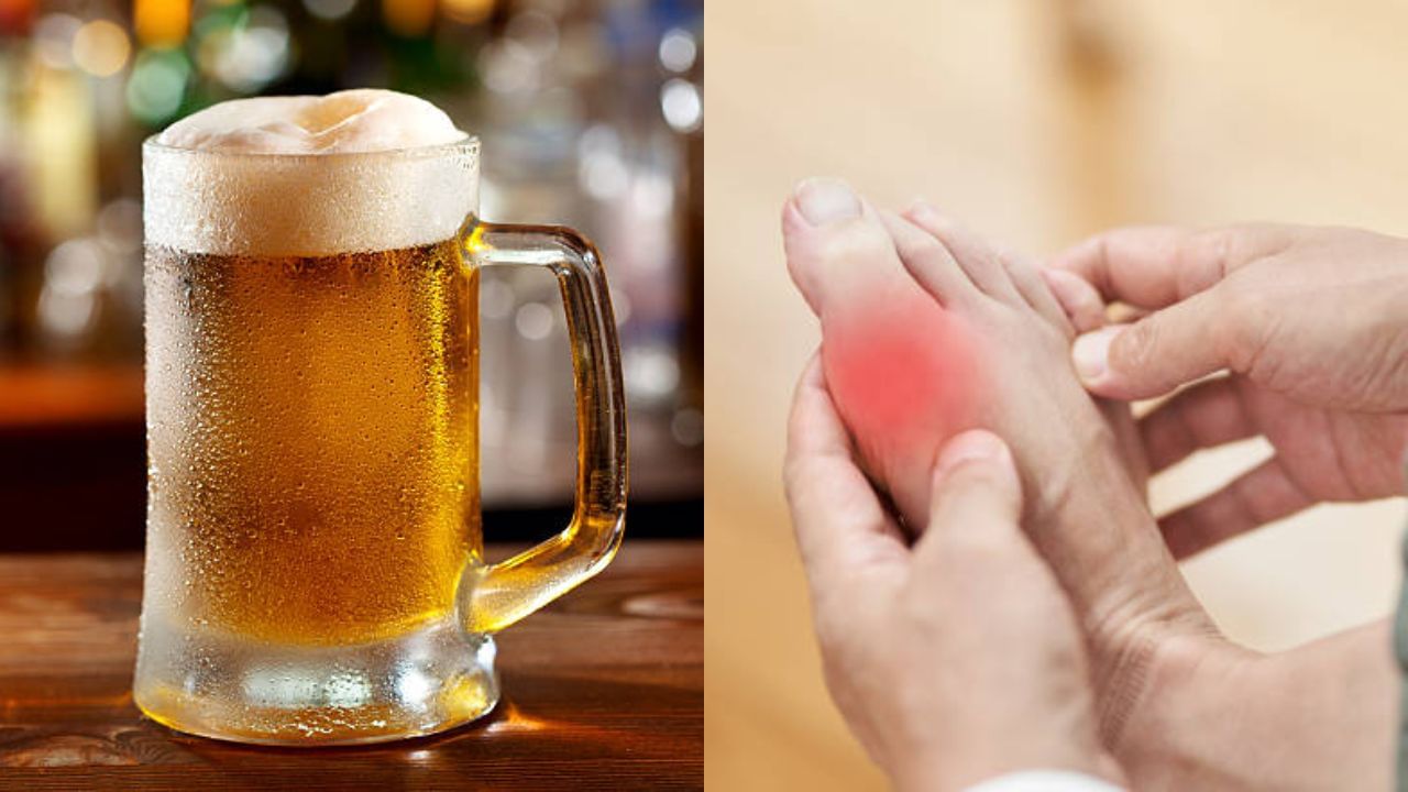 Uric Acid সারা সপ্তাহ ডায়েটে থেকে উইকএন্ডে বিয়ারে চুমুক! ইউরিক