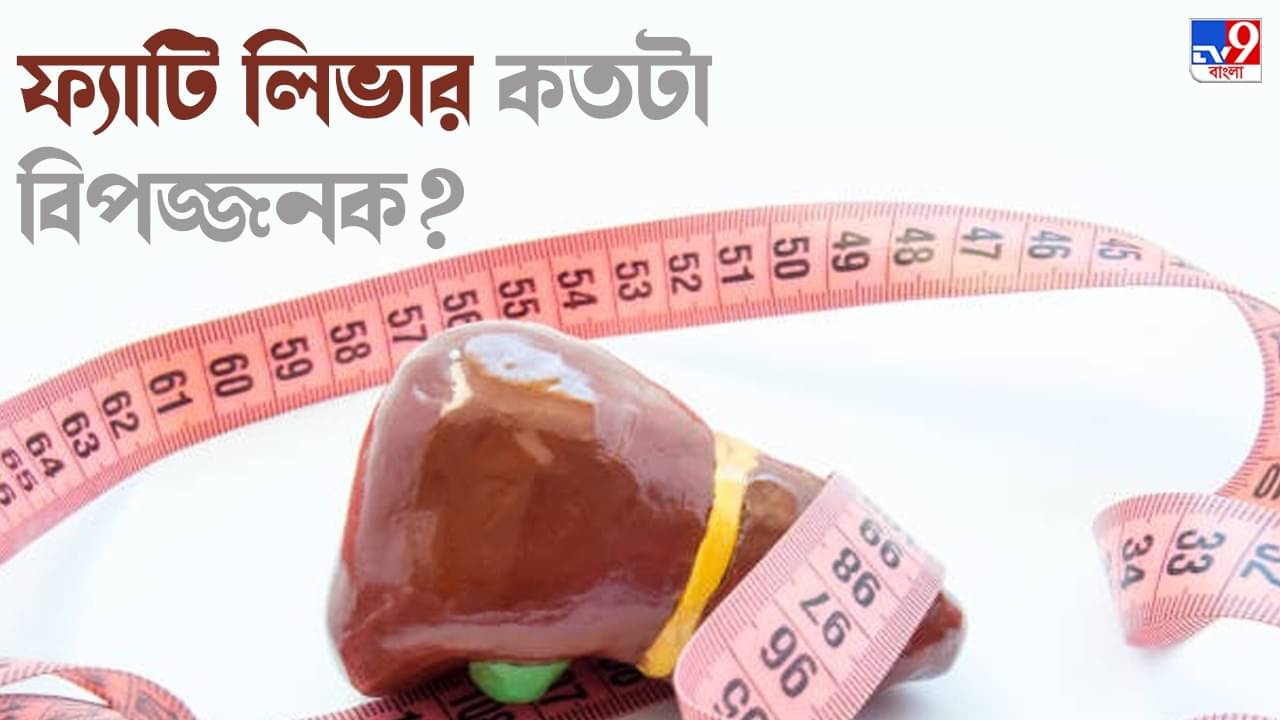 Fatty Liver Diet: কফি, গ্রিন টি, রসুন, সয়াবিন... ফ্যাটি লিভারের সমস্যা দূর করতে কী-কী টিপস দিলেন পুষ্টিবিদ