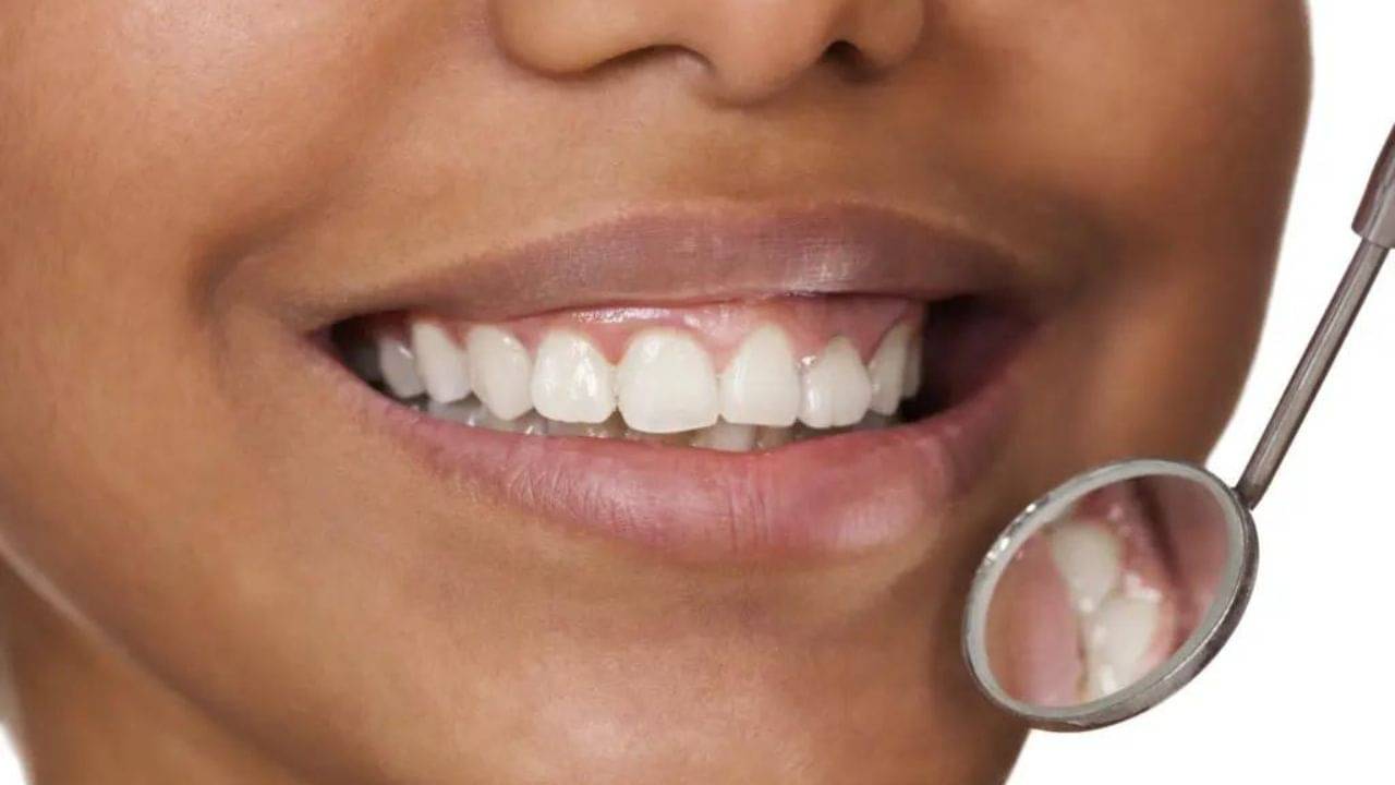 Dark Gum Problems: দাঁতের মাড়ি কালো বলে হাসতে ভুলে গিয়েছেন?  সমস্যা দূর করতে রইল সহজ ও ভেষজ উপায়