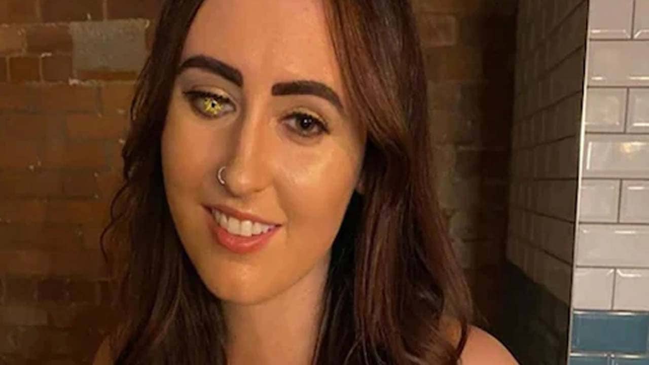 Golden Eye: চক্ষে তাঁহার স্বর্ণ! ট্রোলিং থেকে বাঁচতে অভিনব উদ্যোগ ব্রিটিশ তরুণী