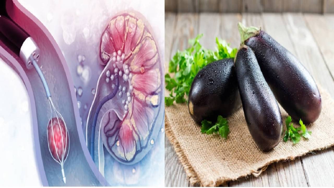 Uric Acid: বর্ষার এই ৫ সবজি রক্তে বাড়িয়ে দেয় ইউরিক অ্যাসিডের পরিমাণ