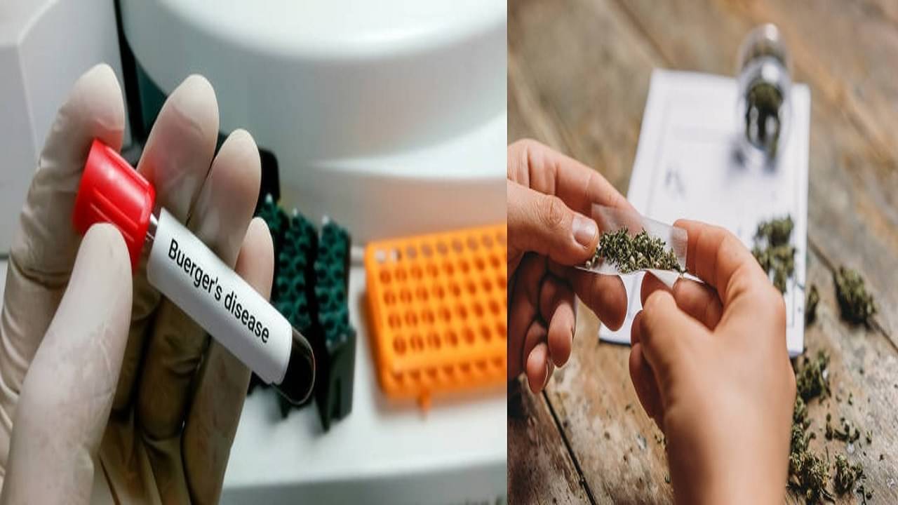 Buerger disease: ব্যথা কমে না, থাকে শরীরে পচনের সম্ভাবনা, নেই স্থায়ী প্রতিকারও! জানুন কী এই বুর্গার রোগ
