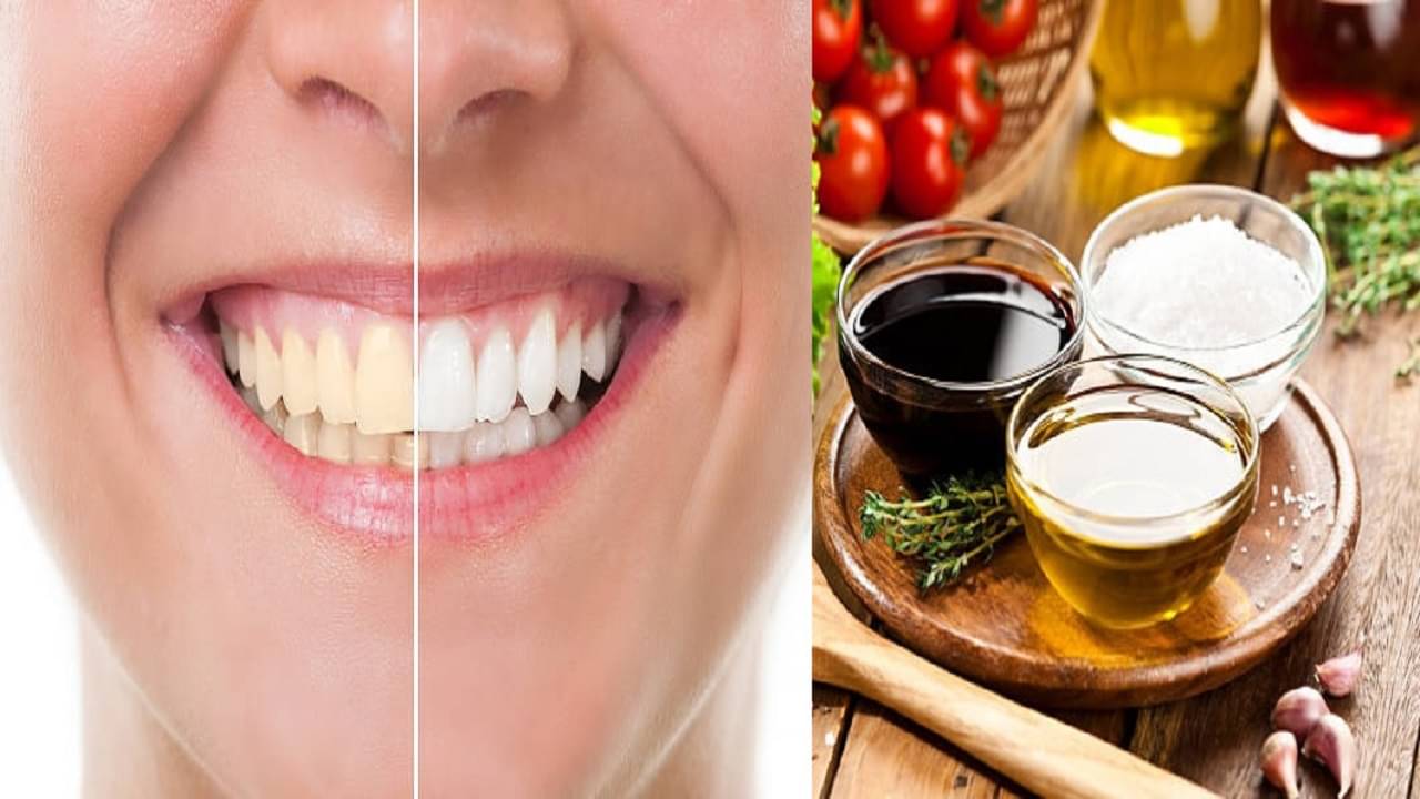 Teeth whitening at home: ১ চিমটে নুনের সঙ্গে স্রেফ ২ ফোঁটা সরষের তেল! কোনও রকম খরচ ছাড়াই দাঁত থাকবে ঝকঝকে, দূর হবে দুর্গন্ধ