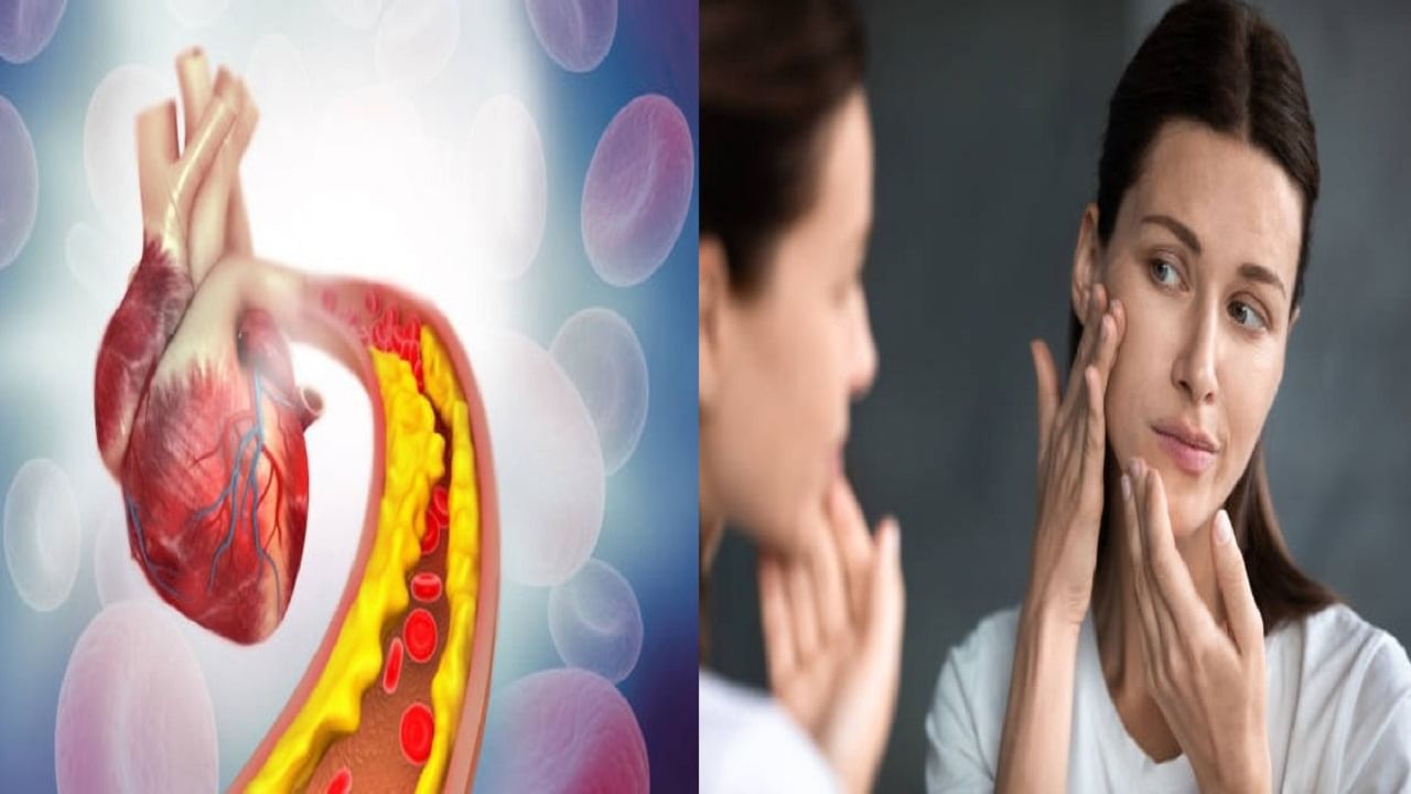 High Cholesterol Sign কোলেস্টেরল কি বেড়েছে, আপনার ত্বকের এই লক্ষণ