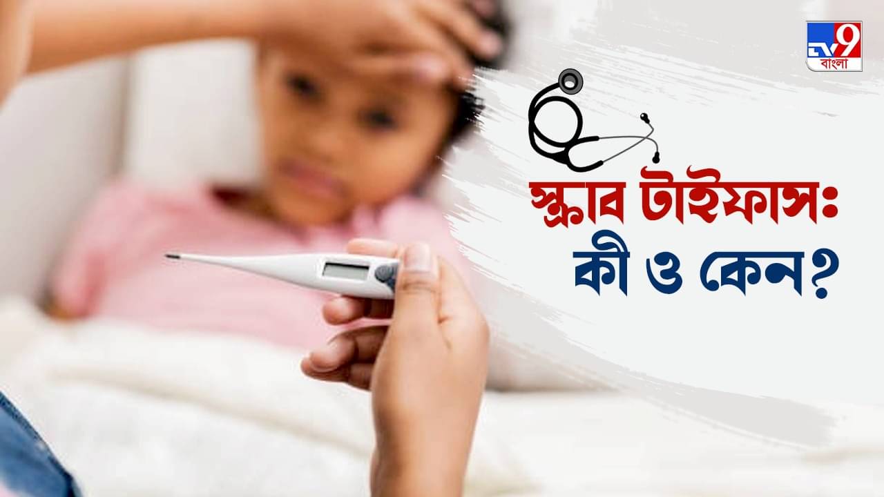 Scrub Typhus: সাতদিন পরও জ্বর যাচ্ছে না বাচ্চার? স্ক্রাব টাইফাস কি না, আজই ডাক্তার দেখান