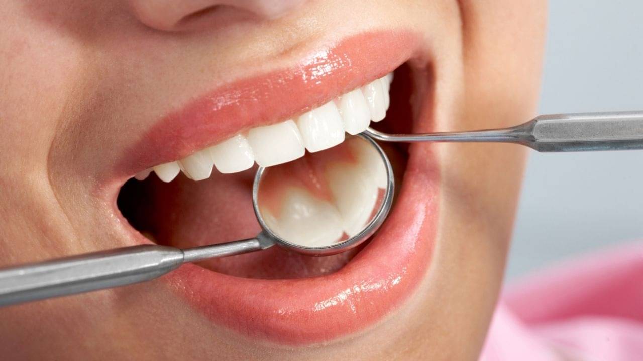 Ayurvedic Tips: ডেন্টিস্টের কাছে আর যেতে হবে না! দাঁত ও মাড়ির যেকোনও সমস্যায় কাজে লাগান এই ৫ আয়ুর্বেদ টিপস
