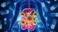 Cancer Risk Factor Cancer Risk Factor