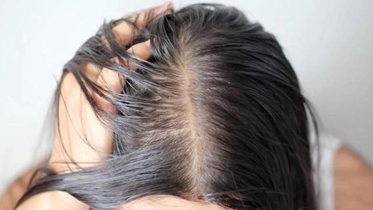 Rid of Baldness: চুল ঝরে কপাল হচ্ছে চওড়া! মাত্র ১ ঘণ্টা এই হেয়ার প্যাক প্রয়োগ করলেই মিলবে ঘন ও সুন্দর চুল