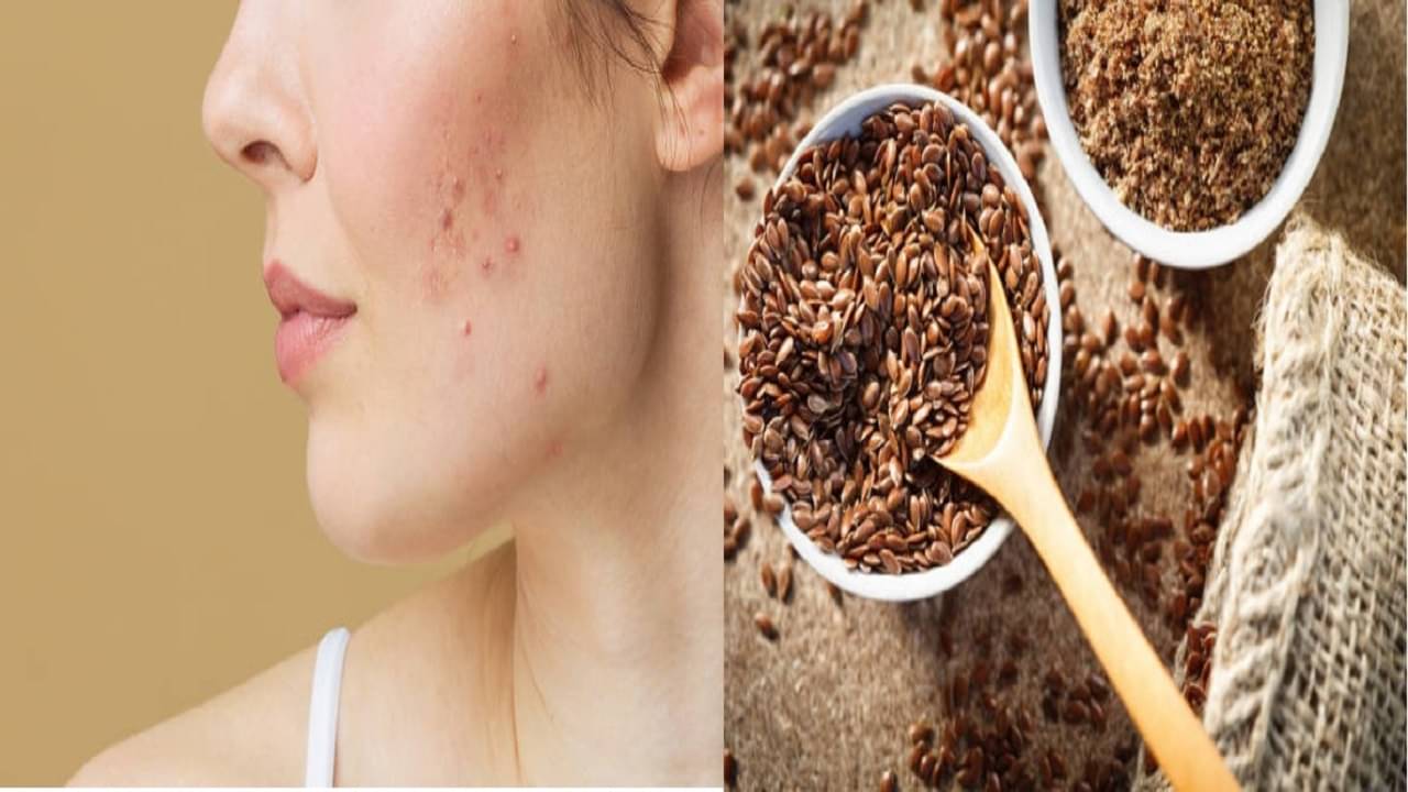 High Androgen: মুখে অত্যধিক লোম, অনিয়মিত পিরিয়ড, শরীরে পুরুষ হরমোনের আধিক্য, কি করণীয়?