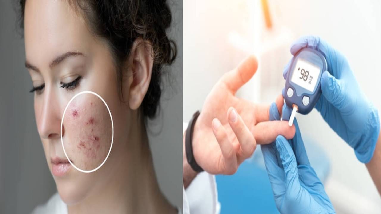 Side effects of sugar: শরীরের ভিতর গলছে চিনি, বাড়ছে সুগার! চিনবেন যে ৬ লক্ষণে