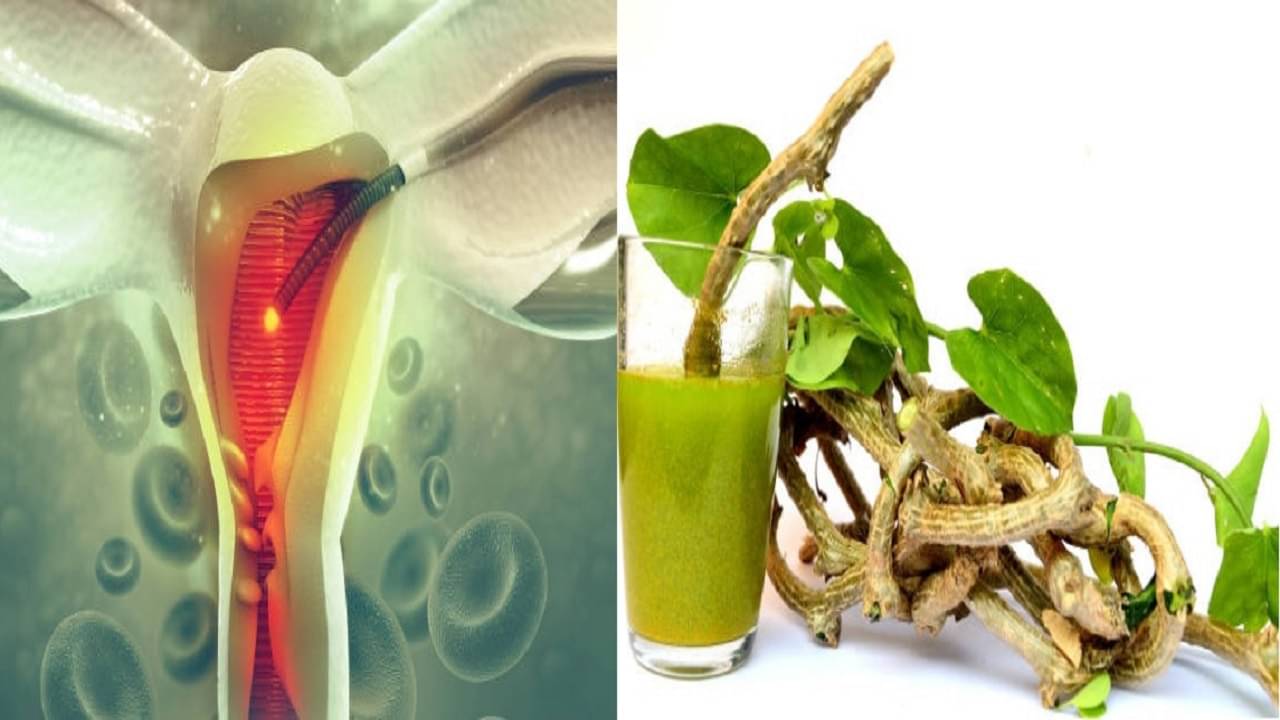 Fibroids Treatment: জরায়ুতে ফাইব্রয়েডের সমস্যা এখন ঘরে-ঘরে, আয়ুর্বেদের এই টোটকা মানলে লাগবে না কোনও ওষুধ!
