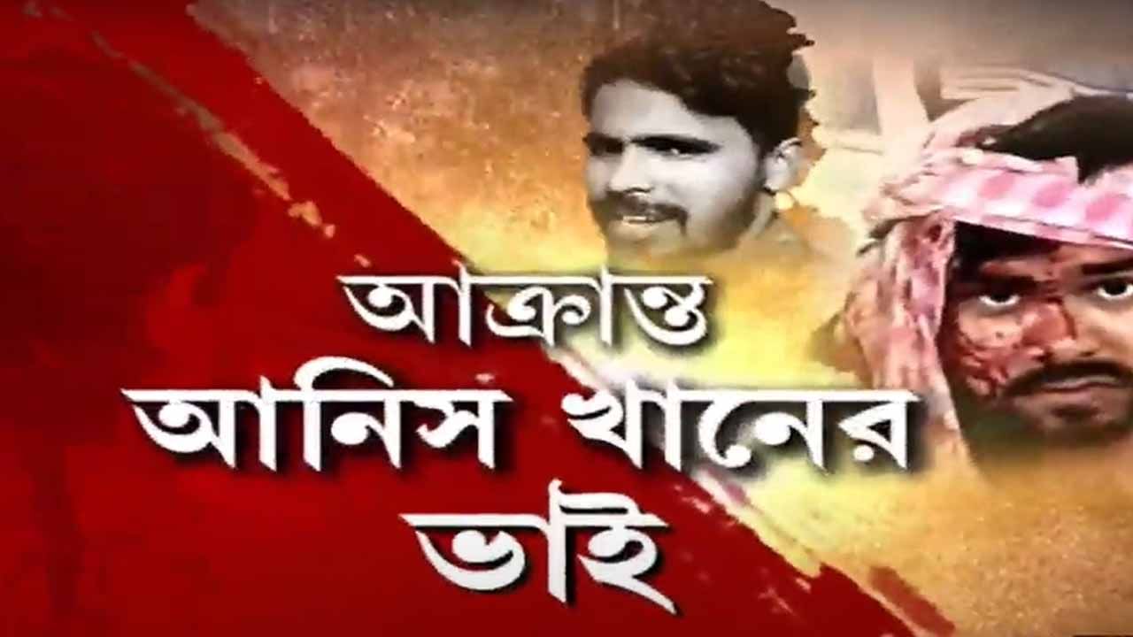 Anis Khan: ৮ ঘণ্টা পরেও মেলেনি সিটি স্ক্যানের রিপোর্ট, সলমনের চিকিৎসায় উঠছে উদাসীনতার অভিযোগ