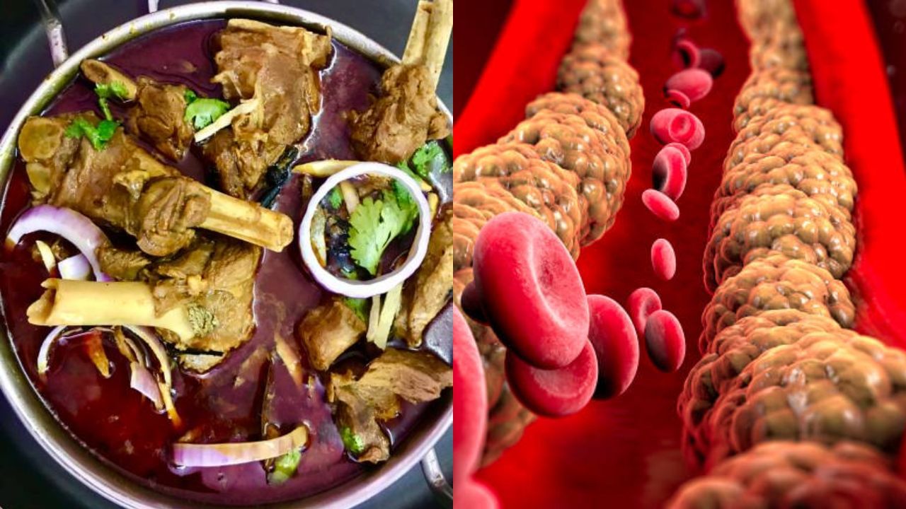 Cholesterol সামনেই পুজো, লাগামহীন খাওয়াদাওয়ার মাঝে কোলেস্টেরলের