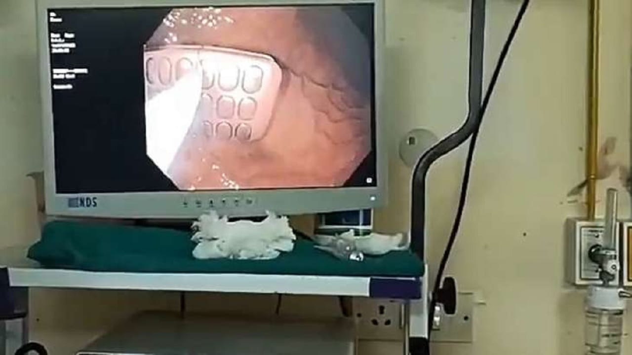 Mobile Phone Swallowed জেলের মধ্যে ব্যবসার পরিকল্পনা, চারচারটে মোবাইল