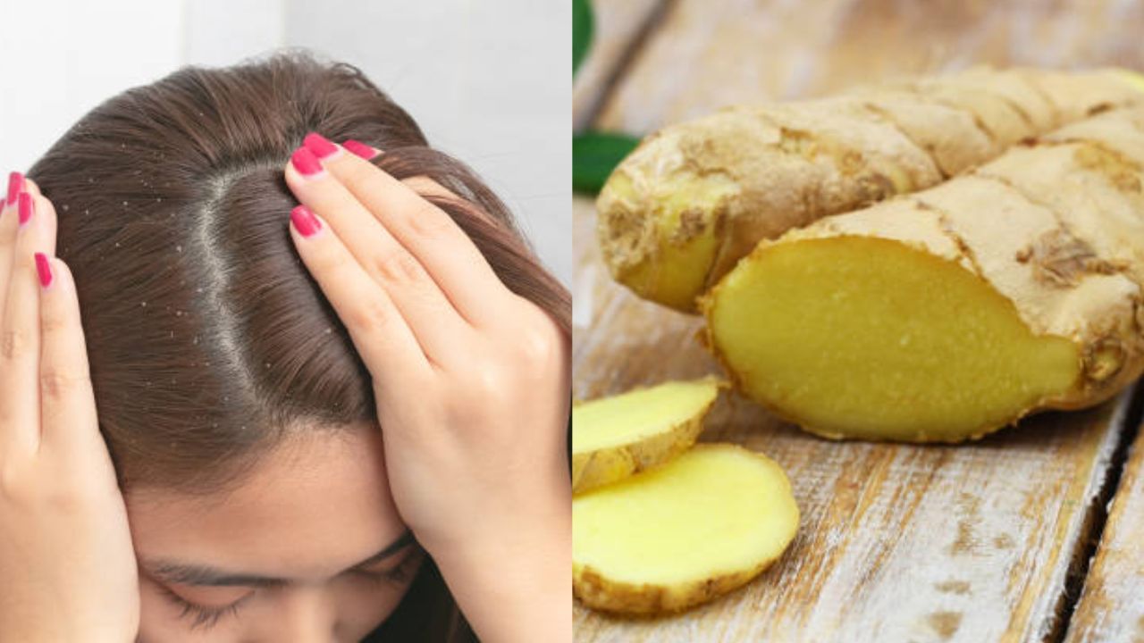 Hair Care Tips অ্যান্টিড্যানড্রাফ শ্যাম্পুতে কাজ দিচ্ছে না? খুশকি দূর