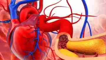 Test for heart disease: হৃদরোগ, হার্ট অ্যার্টাক এবং স্ট্রোকের ঝুঁকি এড়াতে সময়মতো এই ৭ পরীক্ষা অবশ্যই করান