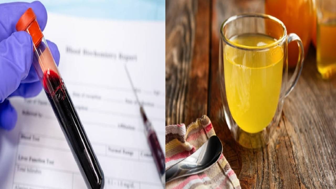 Uric Acid: গাউটের ব্যথায় কাতর? যে উপায়ে খাবেন অ্যাপেল সিডার ভিনিগার