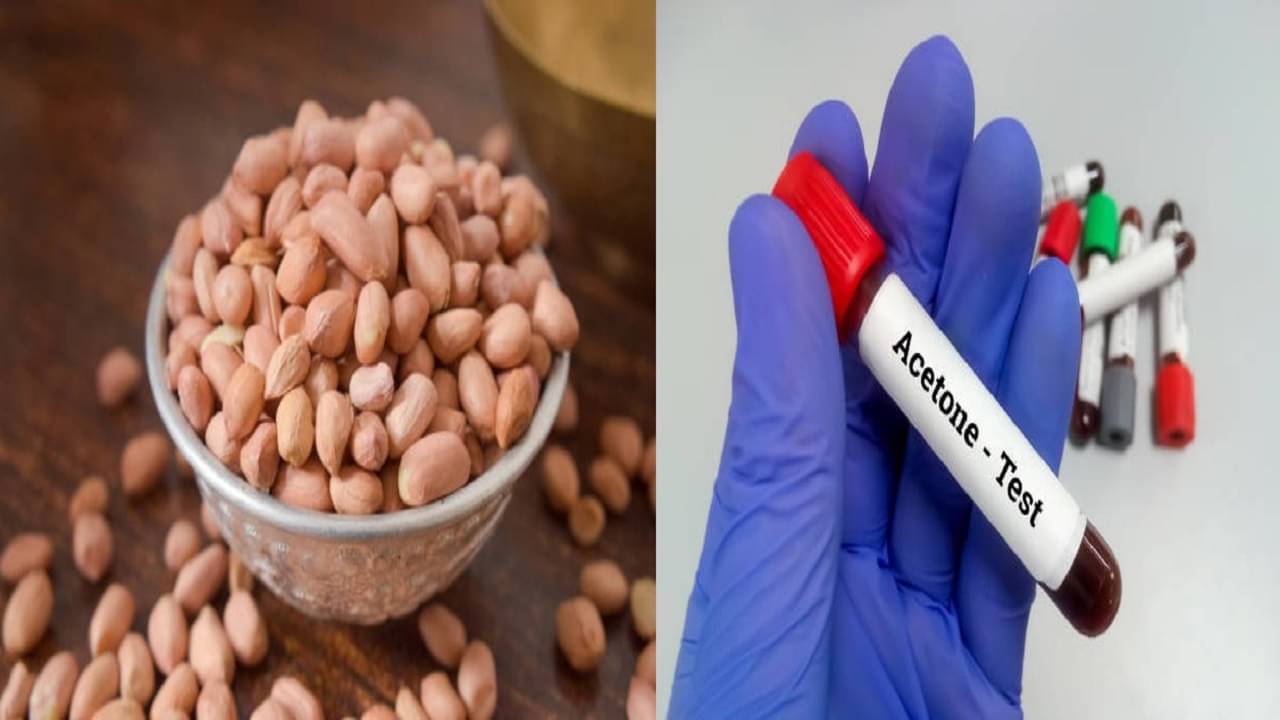 Peanut Side Effect: বাদাম ভাজা খেতে ভাল তবে অতিরিক্ত নয়, নইলে পড়তে পারেন বিপাকে!