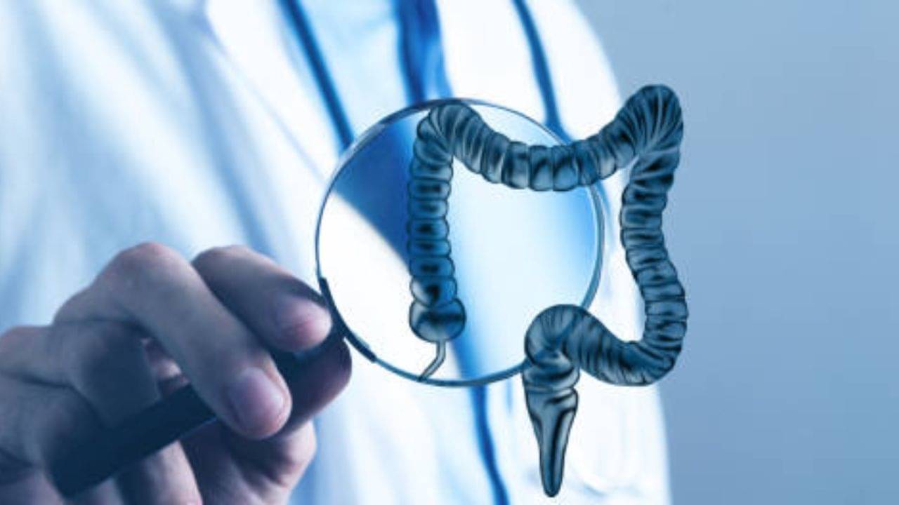 Ulcerative Colitis: পেট ফাঁপা মানেই গ্যাস নয় হতে পারে আলসারেটিভ কোলাইটিসও, যে সব খাবার অবশ্যই এড়িয়ে চলবেন