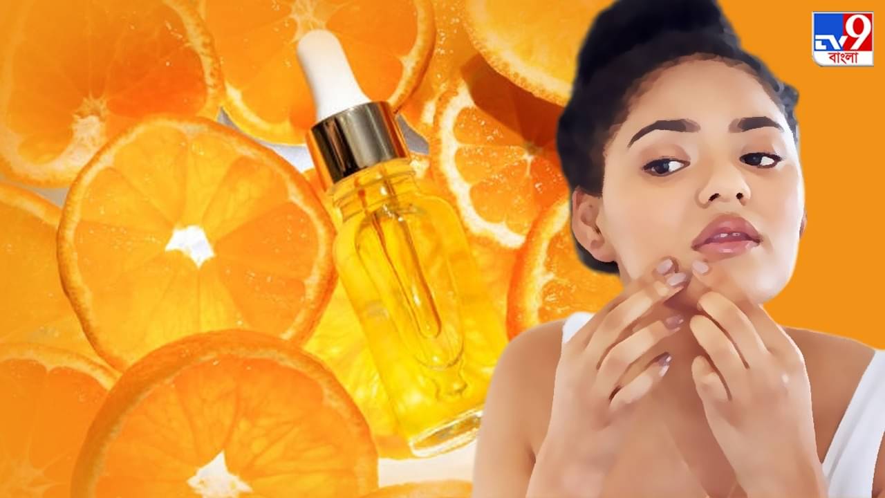 Vitamin C For Skin: ত্বকের জন্য ভাল ভিটামিন সি তবে এইভাবে ব্যবহার করলে কমবে জেল্লা, হতে পারে ব্রণর সমস্যাও