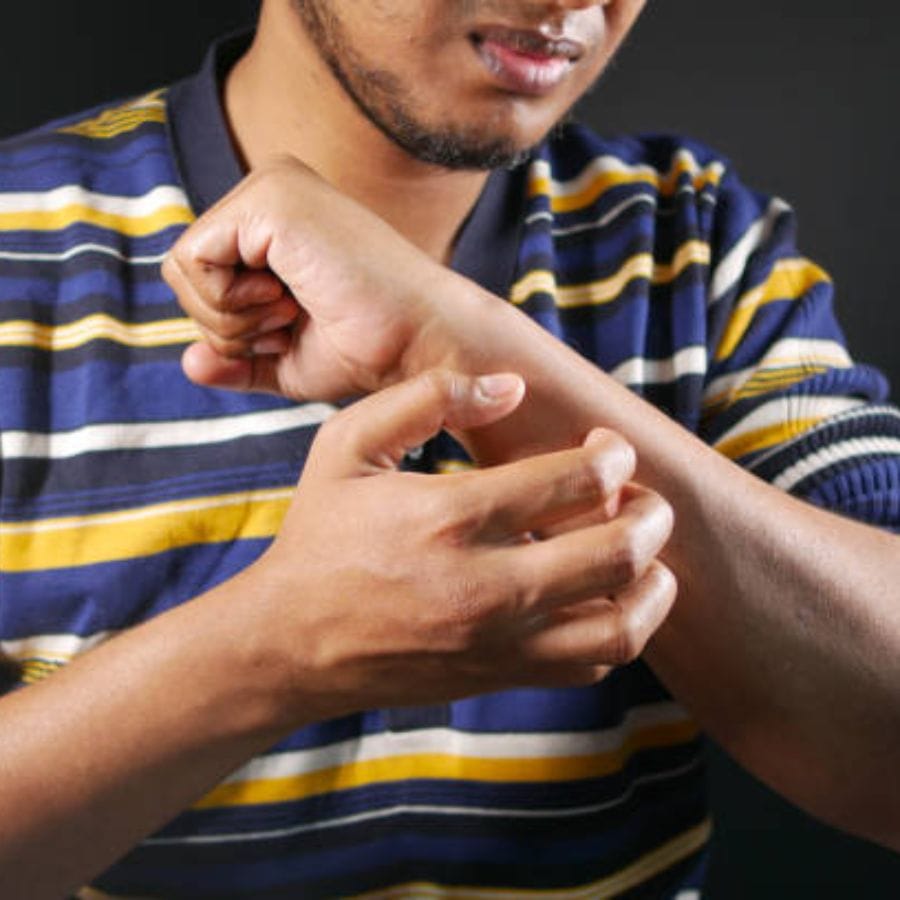 আর তাই চুলকানির সমস্যায় সবচেয়ে ভাল হল কাঁচা হলুদ আর নিমপাতা। রোজ সকালে ঘুম থেকে উঠে খালি পেটে নিমপাতা আর হলুদ চিবিয়ে খান। চাইলে সামান্য গুড় মিশিয়ে দিতে পারেন। এছাড়াও স্নানের জলে নিমপাতা দিয়ে ফুটিয়ে নিতে পারেন।