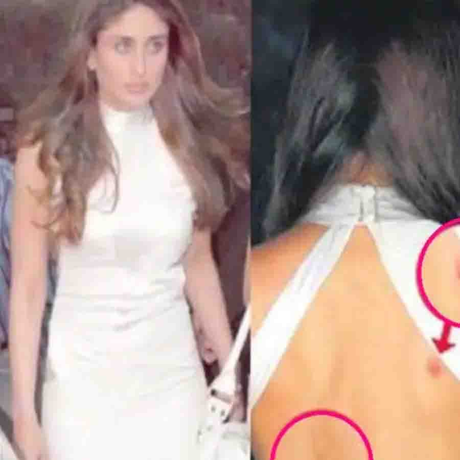 করিনা কাপুর খান - একবার একটি পিঠ খোলা সাদা গাউন পরে প্রকাশ্যে এসেছিলেন করিনা কাপুর খান। কেবল তিনি আসেননি, তাঁর সঙ্গে এসেছিল পিঠের ২-৩টি লাল লিভ বাইটও।