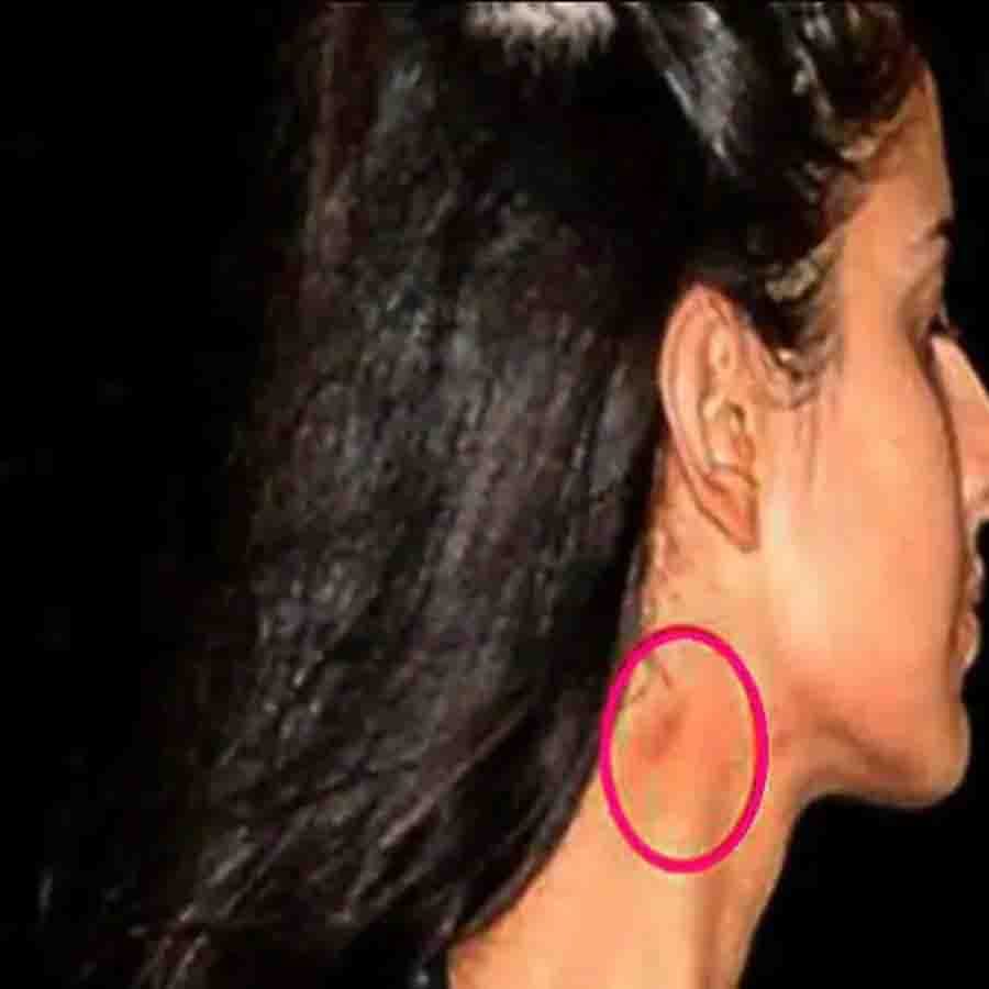 ক্য়াটরিনা কাইফ - ভিকি কৌশলের সঙ্গে বিয়ের আগে একাধিক সম্পর্ক হয়েছে ক্যাটরিনা কাইফের। সবচেয়ে আলোচিত সম্পর্ক ছিল সলমন এবং রণবীর কাপুরের সঙ্গে। কয়েক বছর আগে ক্য়াটরিনার গলায়ও পাওয়া গিয়েছিল ভালবাসার কামড়ের চিহ্ন। 