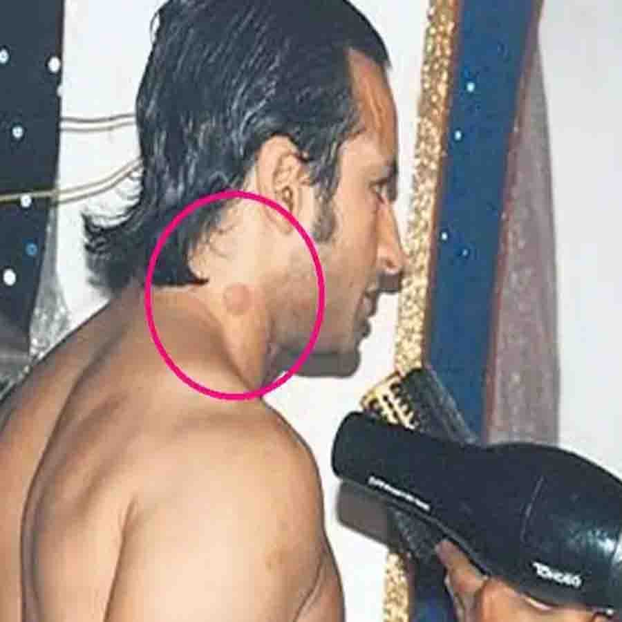 সইফ আলি খান - সইফ আলি খানের গলায় একবার লক্ষ্য করা যায় লাভ বাইট। মেকআপ করার সময় সেই ছবি তোলেন এক পাপারাৎজ়ি। মুহূর্তে ভাইরাল হয়েছিল সেটি। 