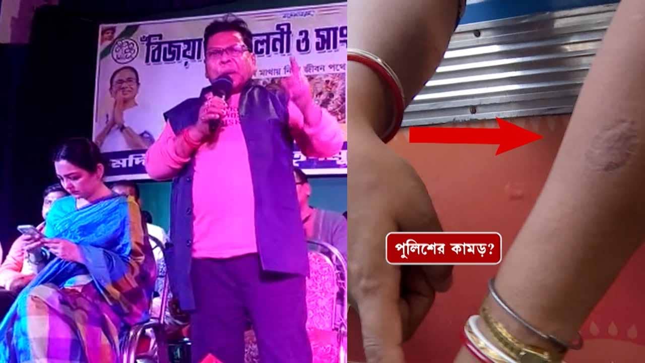 TMC on police: পুলিশ কামড়ে দেবে না তো কি, রসগোল্লা ছুড়বে?, বিতর্কে ঘি ঢাললেন বিধায়ক