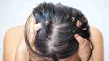 Hair Care Tips: শীত পড়তে না পড়তেই চুল ঝরে পাতলা হয়ে যাচ্ছে? দ্রুত সমাধান পেতে রইল ৫ ভেষজ উপায়
