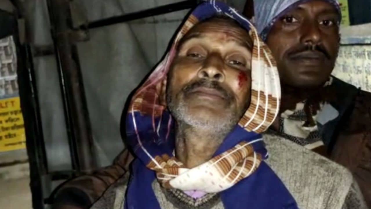 TMC Group Clash: নেপথ্যে সেই গোষ্ঠী কোন্দল, লাঠির আঘাতে তৃণমূল কর্মীর হাত-পা ভেঙে দেওয়ার অভিযোগ দলেরই সদস্যের বিরুদ্ধে