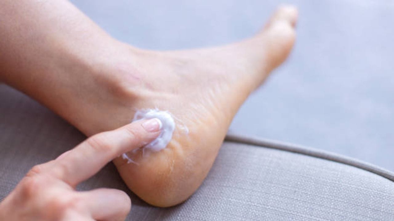 Cracked Heel Cracked Feet Before Winter? apply wax instead of cream