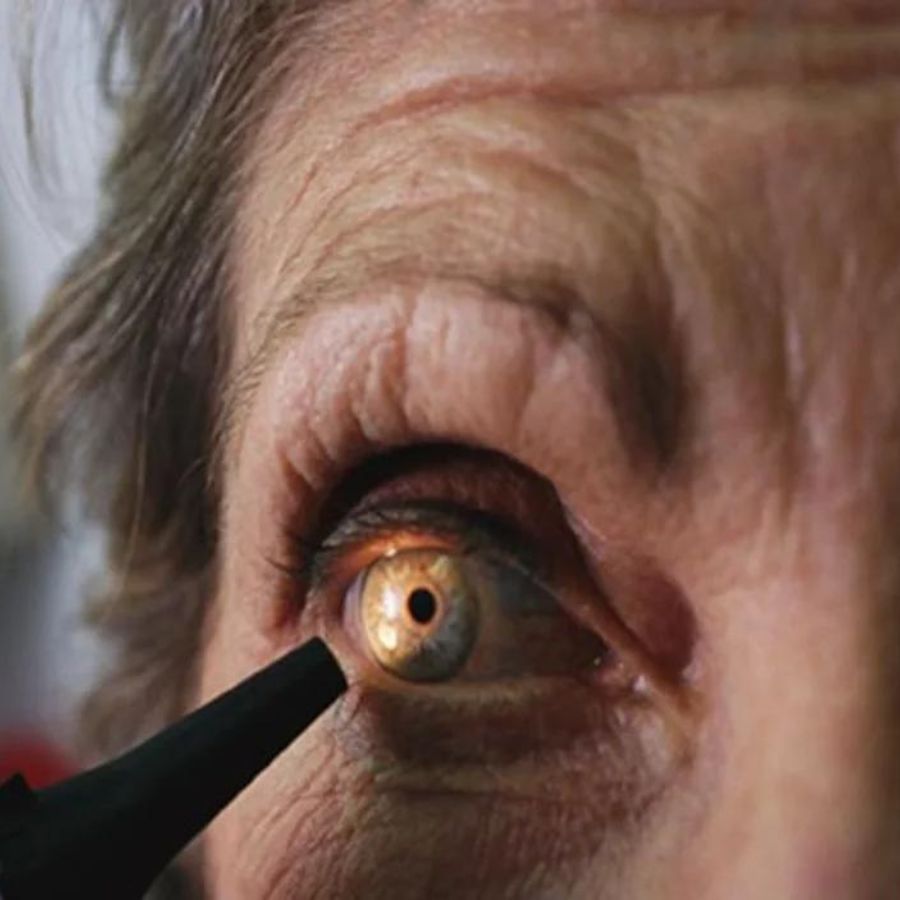 Stay Dehydrated – Water is essential to keep eyes and body hydrated. Throughout the day, dust, sand, dirt enters and hides in the eyes. Dehydration can cause dry eyes. May become red and swollen. Drink plenty of water daily to avoid such problems. Eyes will be hydrated and healthy.