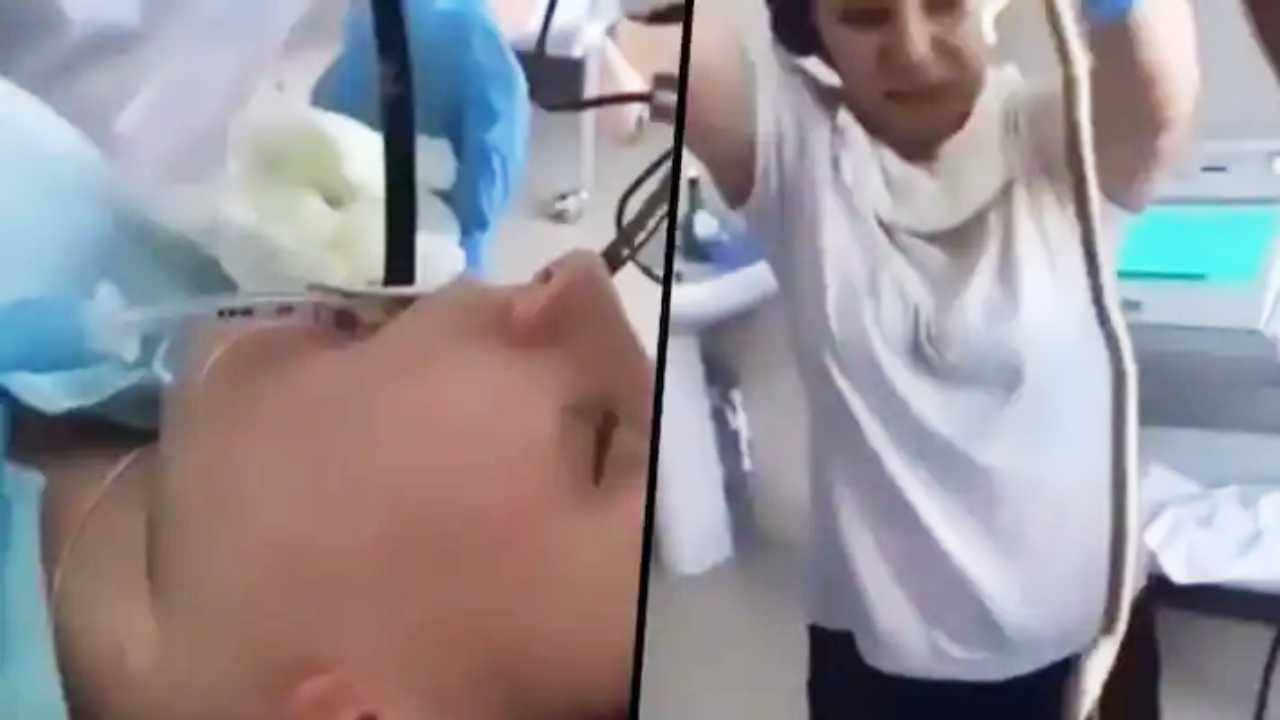 Video: মহিলার খাদ্যনালীতে ৪ ফুট দীর্ঘ সাপ, বহু কষ্টে বের করলেন ডাক্তাররা