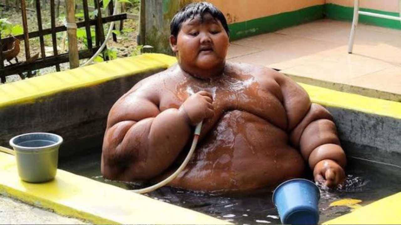 Indonesia: ওজন ছিল ১৯০ কেজি, বিশ্বের সবথেকে মোটা কিশোরকে দেখে এখন চেনার উপায় নেই